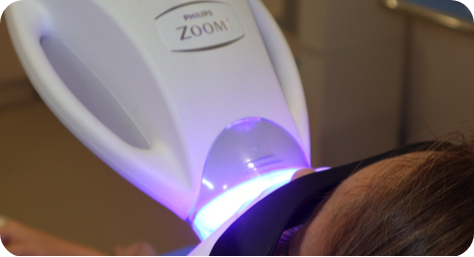 Ativação com Luz Led